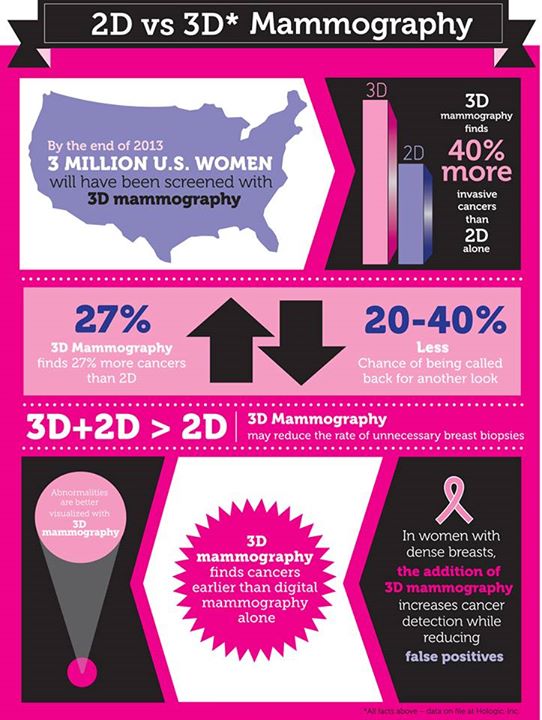 3D Mammogram